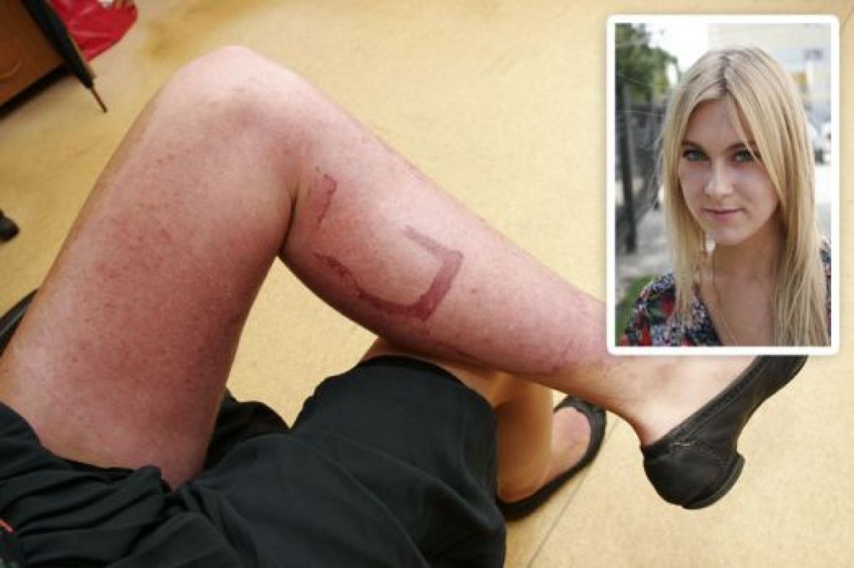 После происшествия на занятиях по вождению Таня носит длинные юбки, чтобы никто не видел её ног