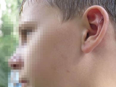Пенсионер избил соседского ребёнка и прокусил ему ухо