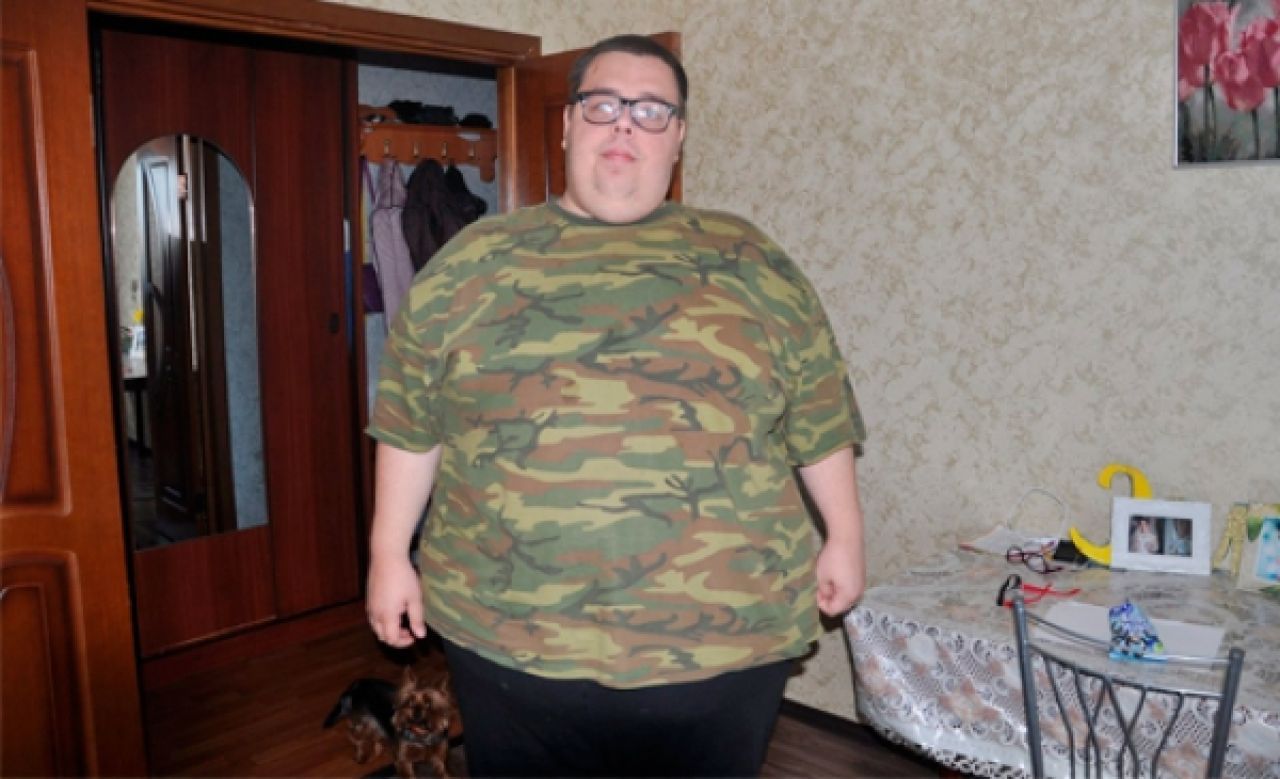 30-летний липчанин, который собирал средства на операцию для похудения, сбросил 50 кг
